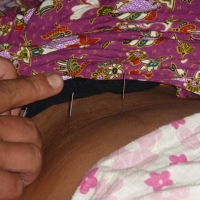 belly-needles